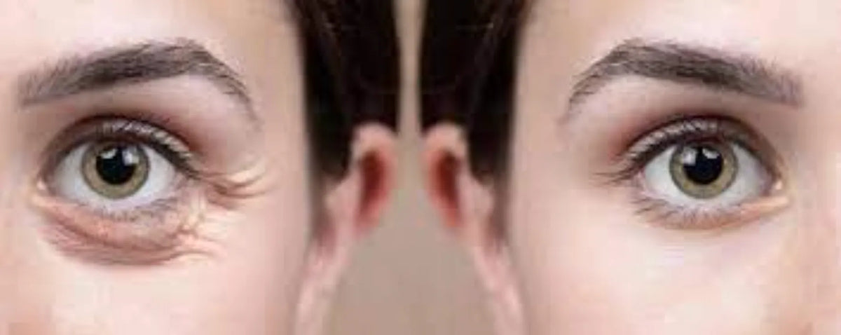 Lumi Eyes polynucleotide eye-area treatment product