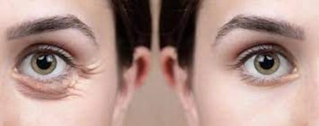 Lumi Eyes polynucleotide eye-area treatment product